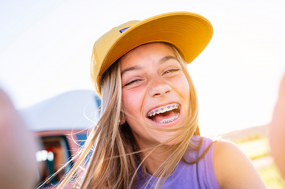 Zahnspange Ablauf – Schritt für Schritt zu deinem neuen Lächeln