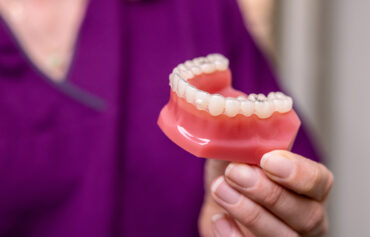 Aligner