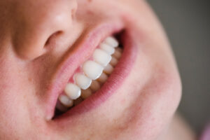 Zähne einfach erklärt: Aufbau, Gebiss, Nummerierung und Zähne bei Kindern